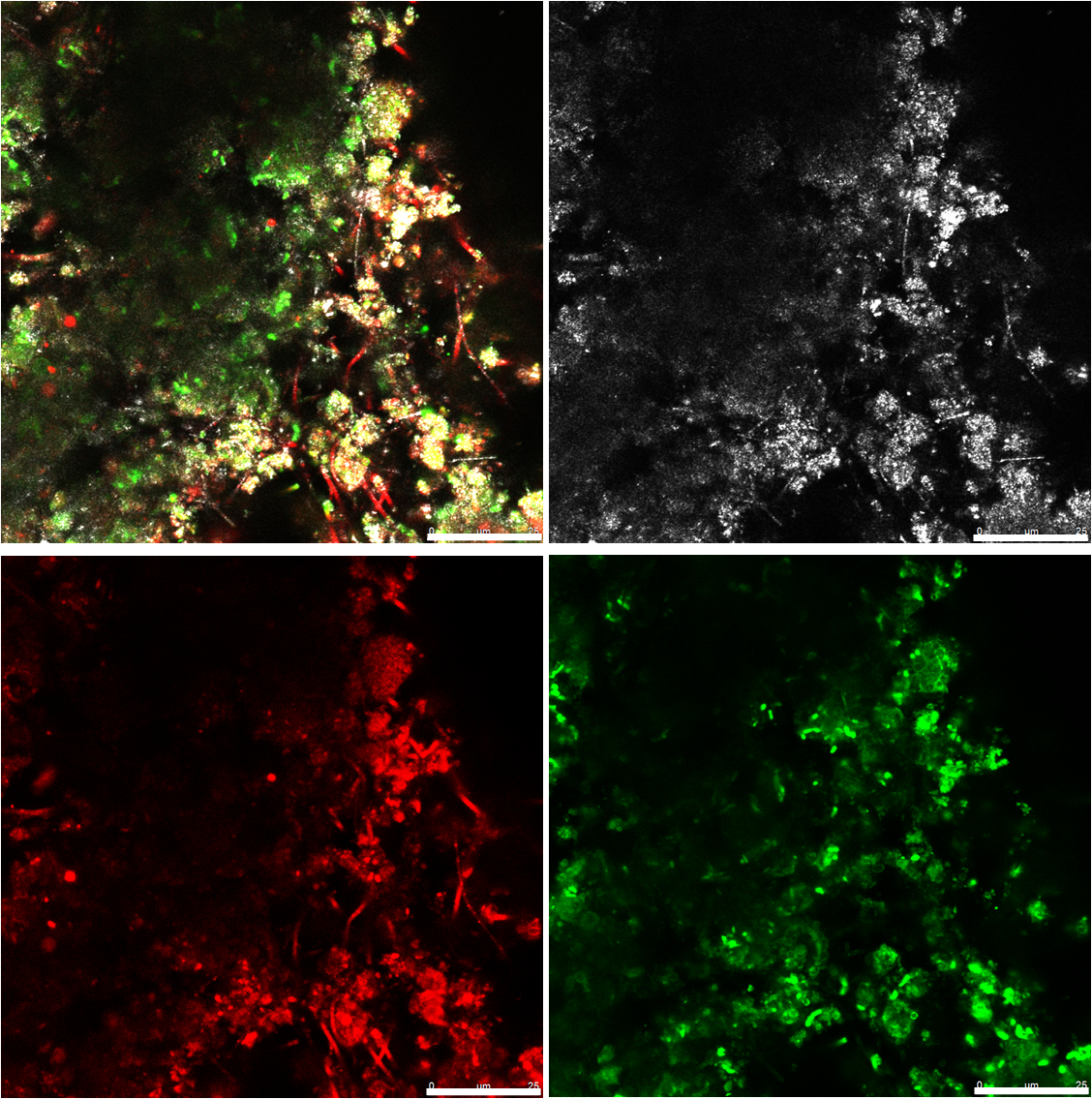 Biofilm aus einem Biogasreaktor. Oben links Overlay von allen drei Fluoreszenzkanälen; oben rechts (weiß) = Reflektionssignal; unten links (rot) = Bakterien und unten rechts (grün) = extrazelluläre polymere Substanzen (EPS). cLSM Aufnahme.