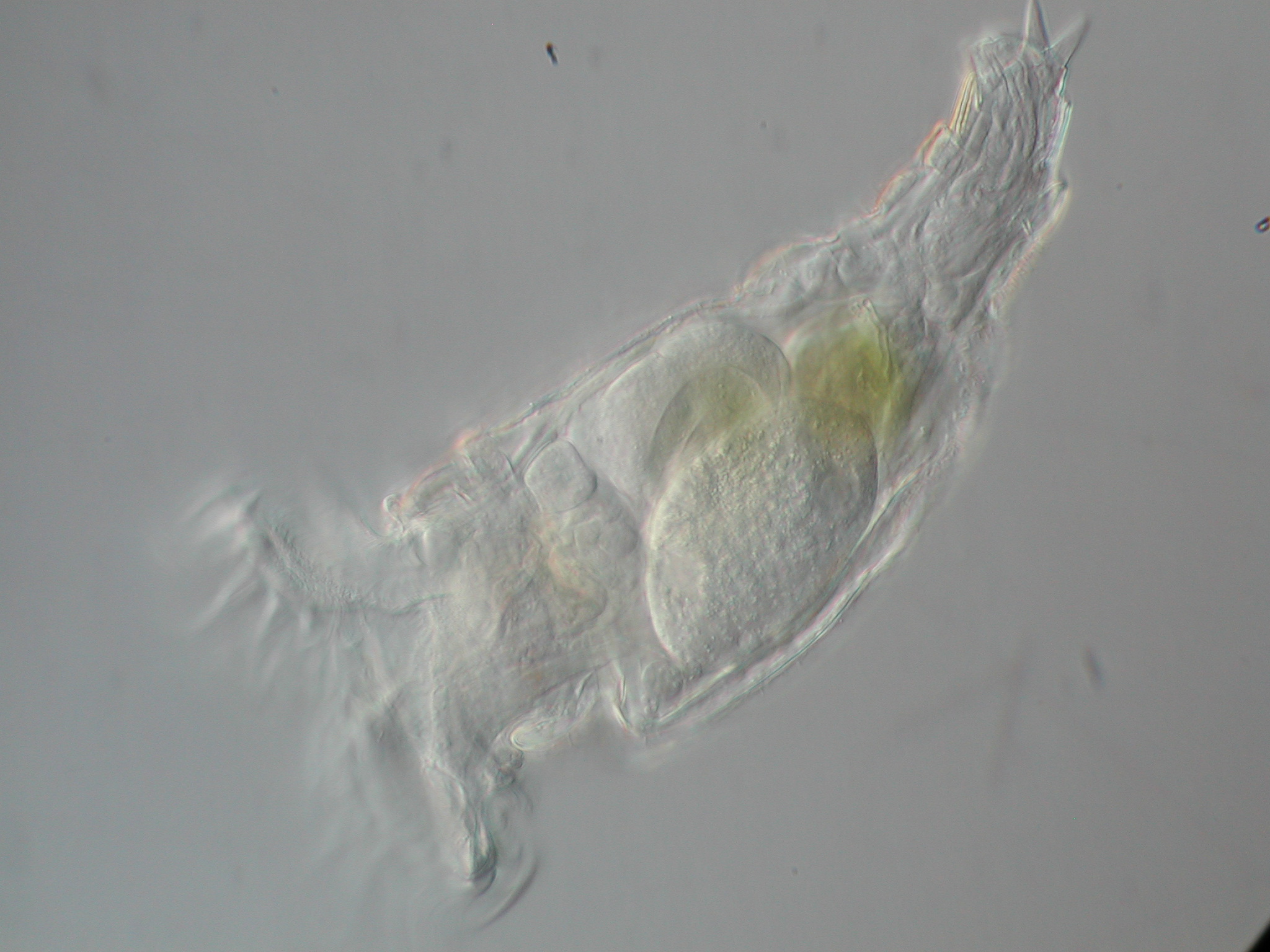 Rädertierchen in einer Belebtschlammprobe. Lichtmikroskopische Aufnahme; 400x.