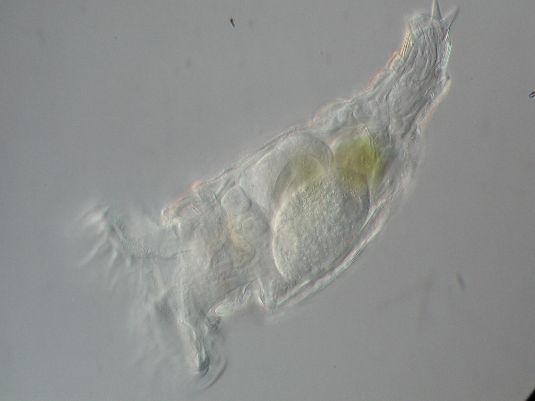 Rädertierchen in einer Belebtschlammprobe. Lichtmikroskopische Aufnahme; 400x.