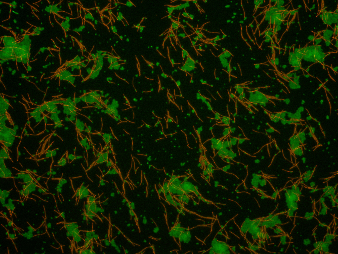 Fluoreszenz in Situ Hybridisierung (FISH) einer Mischkultur von E.coli (grün) und Methanospirillum hungatei (rot). cLSM-Aufnahme